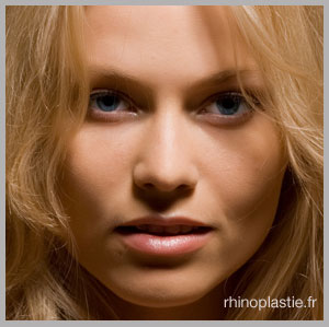 rhinoplasties